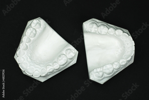 Gypsum model plaster of tooth - Upper View