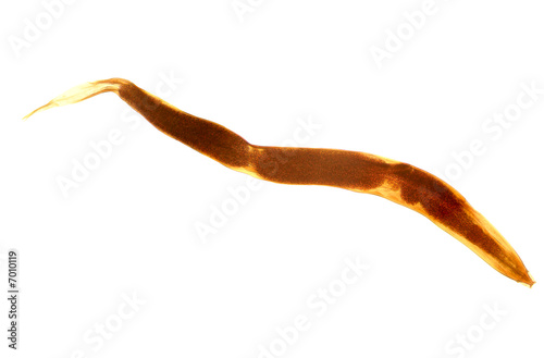 Enterobius vermicularis (pinworm), photomicrograph, isolated. photo