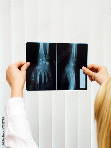 medic holding roentgen of the hand