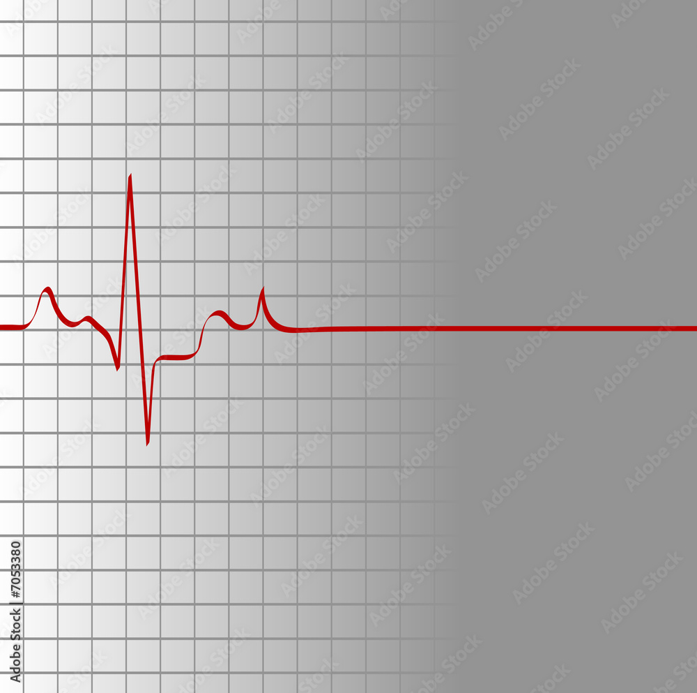 grid with heart beat and then flatline - death grid with heart beat and then flatline - death