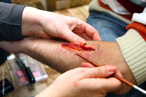 Creation of an artificial wound