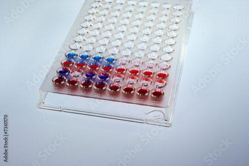 dna test result