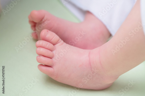 foots of infant