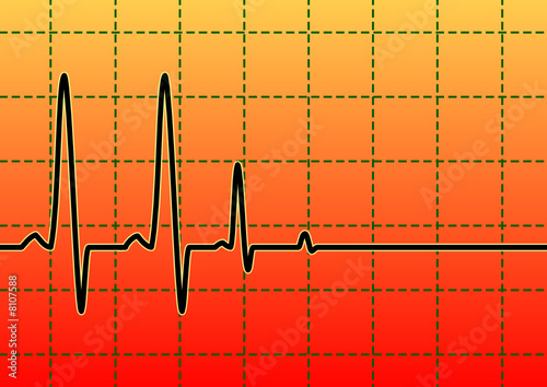 cardio, death