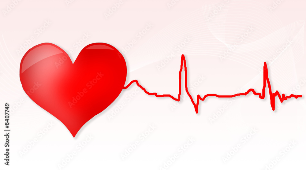 Cardiogramme Cardiogramme