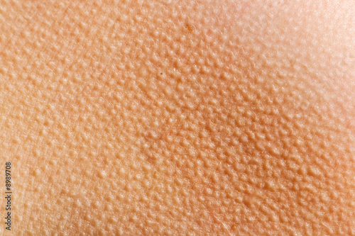 Human skin with goosebumps from the cold photo