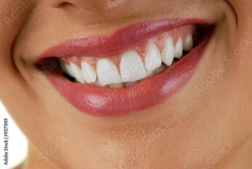 Smiling woman mouth with great white teeth