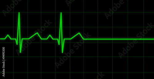 électrocardiogramme