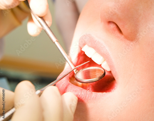 Close-up of patient’s open mouth before oral inspection