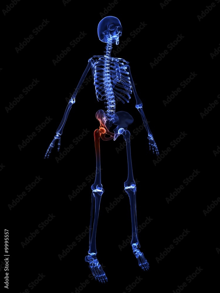 Fototapeta premium schmerzhaftes hüftgelenk
