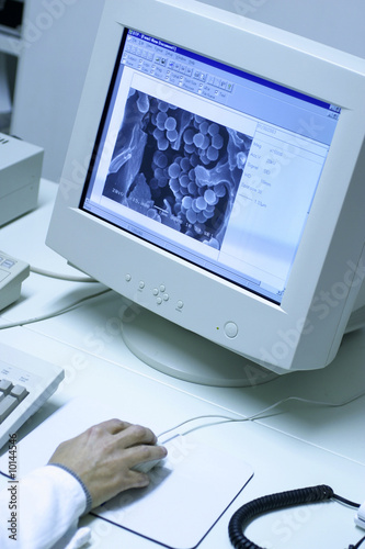microscopio elettronico