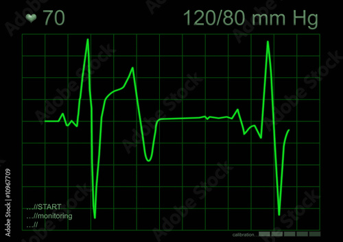 ECG - illustration