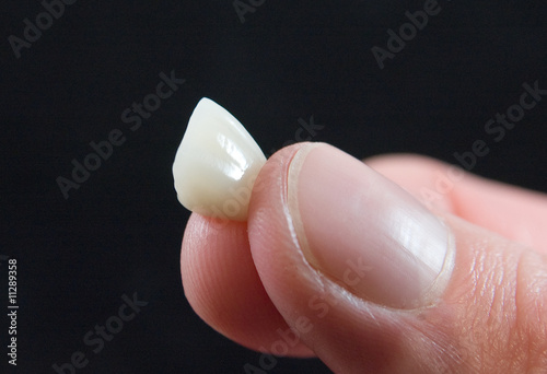 Tooth Crown