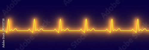 EKG Puls
