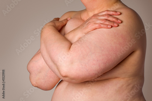 Overweight woman covering breasts