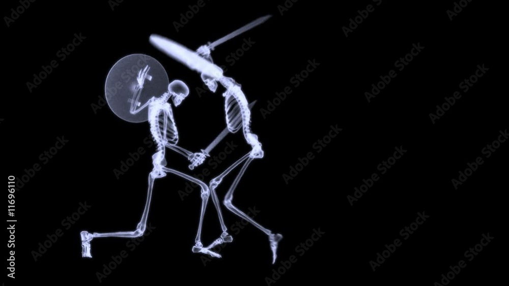 Xray of 2 human skeleton fighting in a sword combat Xray of 2 human skeleton fighting in a sword combat