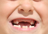 Child's toothless mouth