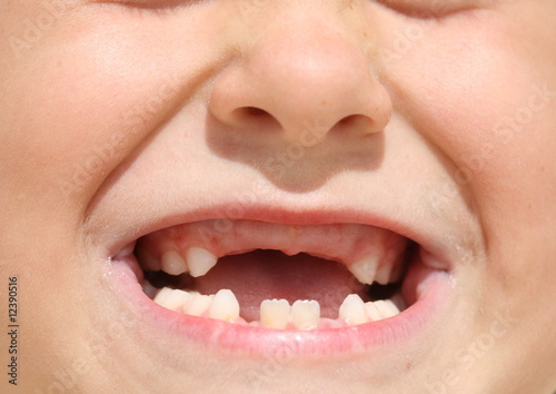 Fototapeta Child's toothless mouth