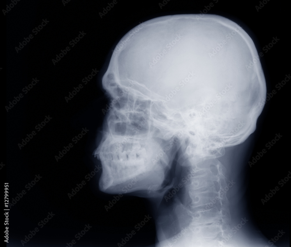 Obraz premium X-ray of a human skull