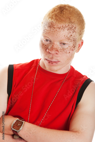 Albino Man photo