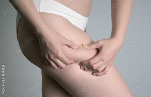 Young woman with cellulite photo
