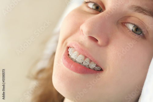 Girl smiles with braces photo