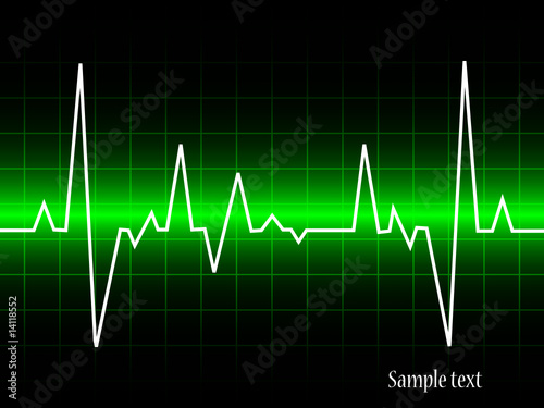 electrocardiogram- vector illustration
