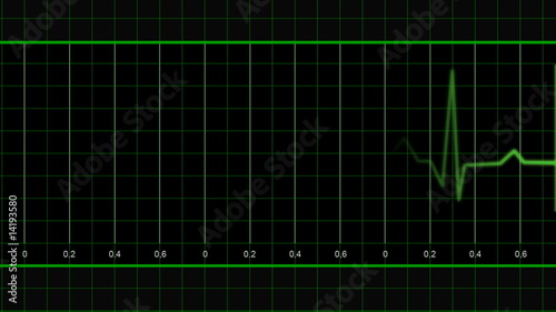 EKG heart trace monitor green