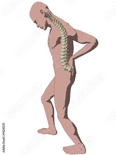 rückenschmerzen / bandscheibenvorfall