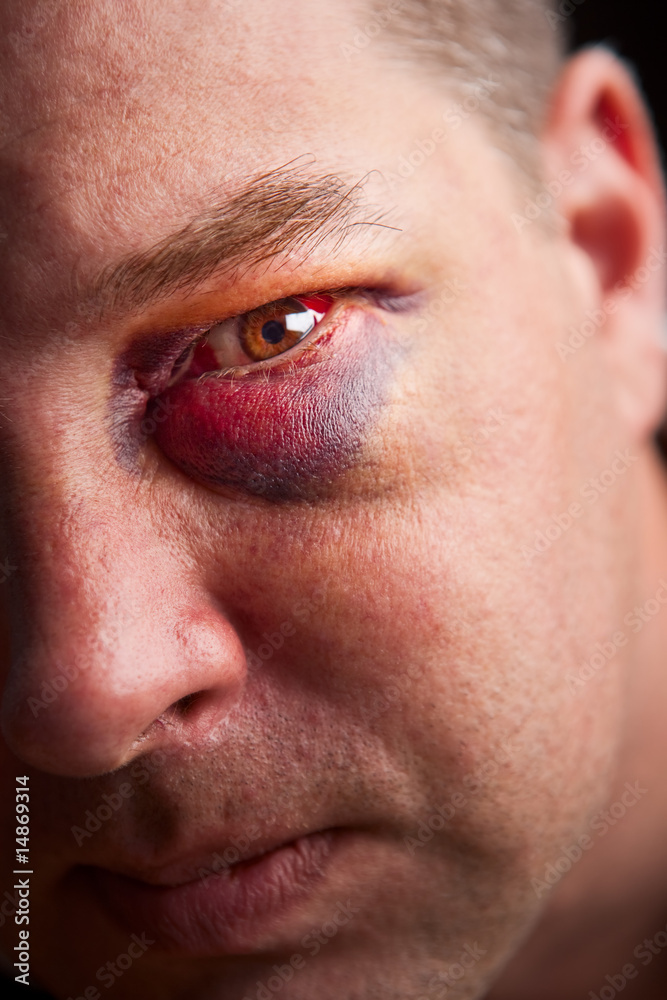 Obraz premium Black eye