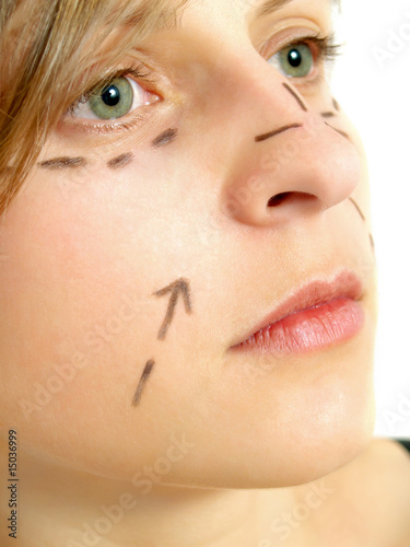 Facial plastic surgery