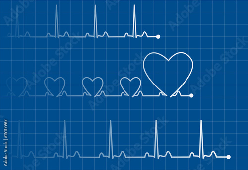 Heartbeats