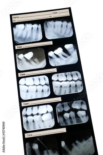 Dental X-ray