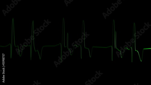 Electrocardiogram