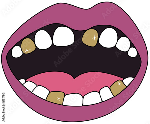 Gold Teeth