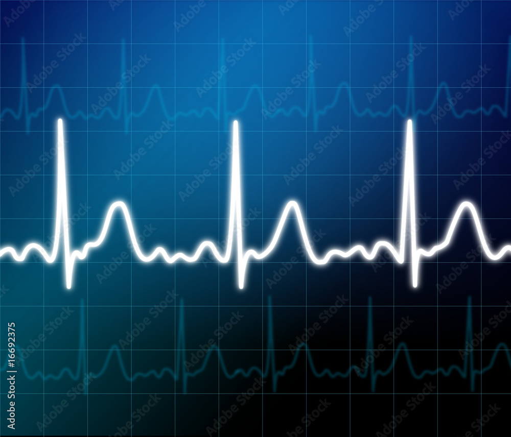 Naklejka premium Illustration of electrical activity of the human heart