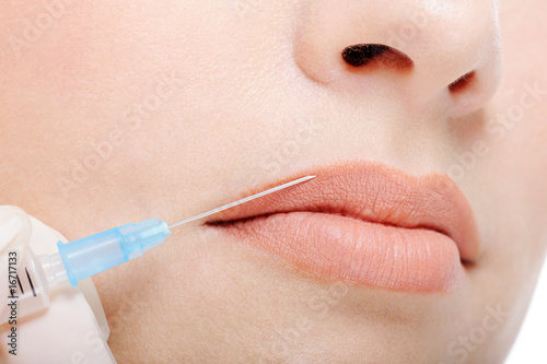 Cosmetic injection in the female lips photo
