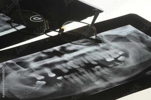 Ortopantomografia panoramica photo