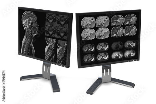 monitor_medical photo