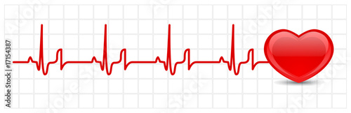 Heart cardiogram