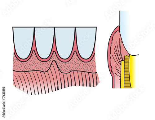 schema denti e gengive - odontoiatria