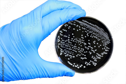 Bacterial Colonies photo
