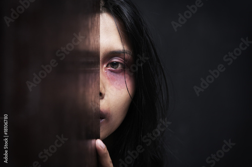 Injured woman hiding in dark photo