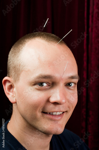 Smiling acupuncture patient