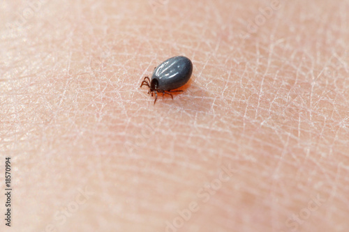 Gemeiner Holzbock - Zecke (Ixodes ricinus)