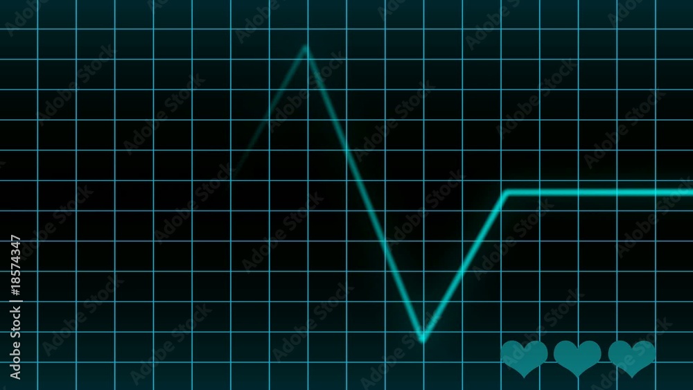 heart rate EKG