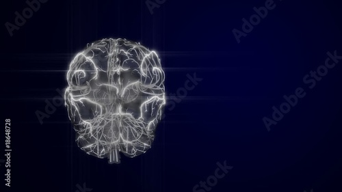 Brain with Vertebralis & Carotis - loop photo