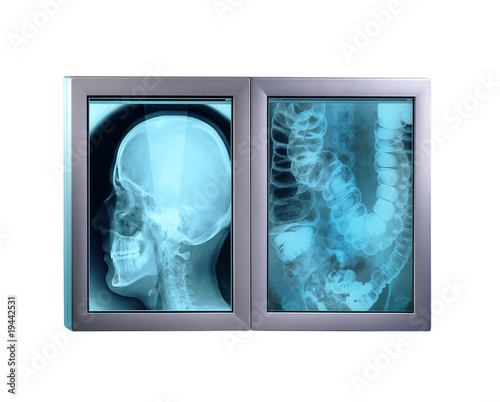 Double x-ray minitor,isolated photo