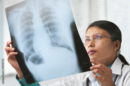 Female doctor checking xray image
