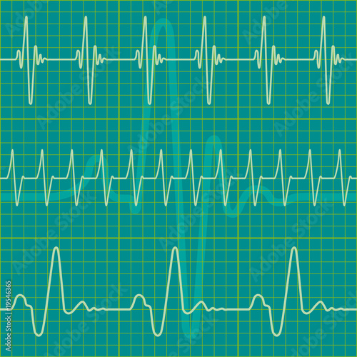 Cardiogram